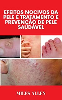 Livro EFEITOS NOCIVOS DA PELE E TRATAMENTO E PREVENÇÃO DE PELE SAUDÁVEL