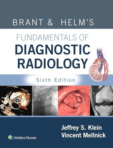 Amazon.com: Learning Radiology E-Book eBook : Herring MD, FACR