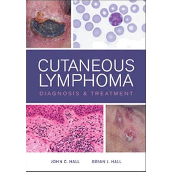 WHO Classification of Tumours of Haematopoietic and Lymphoid
