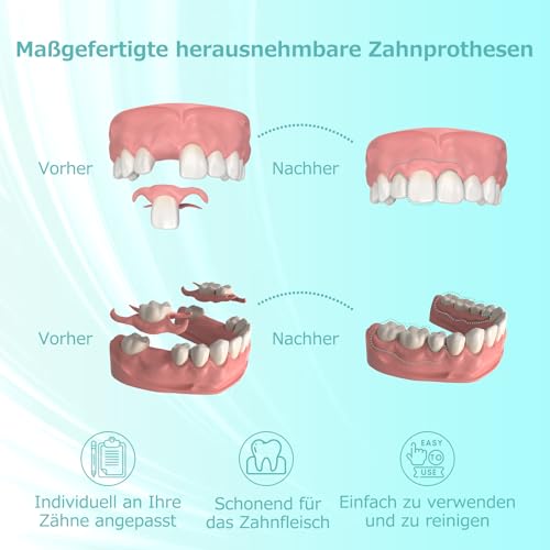 Custom Partial Dental Denture - Temporary Denture, Removable and Temporary Denture. Perfect fit and easy to use to recreate your smile at home (1 tooth)