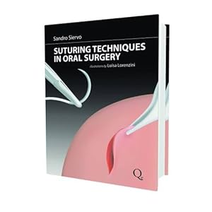 Suturing Techniques in Oral Surgery