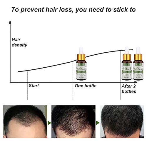 Hair Growth Oil, Hair Oil for Men, Alopecia Areata Treatment, Stops Hair Loss, For Thinning Hair, Alopecia Areata, Promotes Thicker, Fuller ＆ Faster Growing - Thumbnail 6