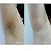 GARYOB Dark Spot Remover Age Spots Oil Ultra Brightening Spotless Oil Hyper-Pigmentation (2PCS)