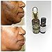 (1 oz / 30 ml) Lactic Acid Peel 88% -Chemical Peel-Unbuffered-Alpha Hydroxy (AHA) For Acne, Oily Skin, Wrinkles, Blackheads, Large Pores,Skin Lightening & Free After Peel Lightening & Brightening Oil