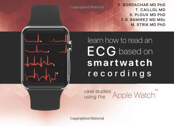 Learn how to read an ECG based on smartwatch recordings: case studies from the Apple Watch (black and white edition)