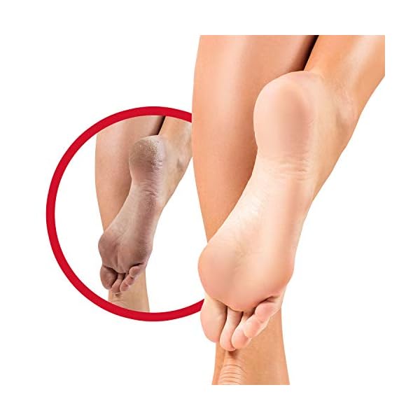 Flexitol-Hard-Skin-and-Callus-Balm-Immediately-Softens-Hard-Skin-and-Callus-Suitable-for-Diabetics-56g Flexitol Rescue Hard Skin and Callus Balm 56g, Softening Foot Cream with Glycolic and Salicylic Acid, Suitable for…