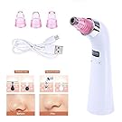 Blackhead Remover,Zoumo Portable Facial Pore Blackhead Acne Removal,Comedone Suction Extractor,Healthy Pore Vacuum Extractor,Rechargeable Comedo Remover, White