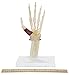 GPI Anatomicals - Hand and Wrist Model, Replica of Hand and Wrist with Carpal Tunnel Syndrome for Human Anatomy and Physiology Education, Anatomy Model for Doctor's Offices, Medical Learning Resources