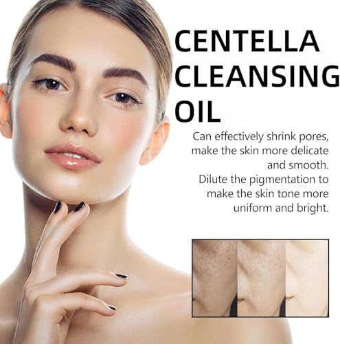 LBOYLOVE® Centella Cleansing Oil, Natural Oil Cleaner, Face Cleanser Women, Oil-Based Facial Cleanser Gentle Makeup Removal, Make Up Remover, Cleansing Oil for Face, Face Wash Women, Gentle Cleanser