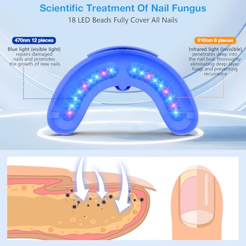 Suuprone Nail Fungus Laser Device, Anti-Fungal Nail Treatment for Toenails/Fingernails Extra Strong, Enhanced Antifungal Laser with 905nm Infrared Light + 470nm Blue Light-White