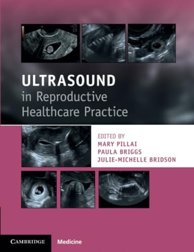 Ultrasound for Primary Care: 9781496366986: Medicine & Health