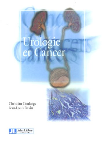 Urologie et cancer