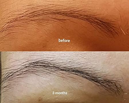 the ordinary hair serum side effects