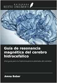 Guía de resonancia magnética del cerebro hidrocefálico: Una guía para la hidromecánica alterada del cerebro