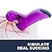 Clitoral Sucking Vibrator, Sexrabbit Rechargeable Heating Dildo Vibrator G Spot Massager Waterproof, Clit Stimulator with 10 Vibration & 3 Suction Patterns Adult Sex Toys for Women Couples