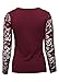 MonsterCloset Cotton Span Top w/ Lace Long Sleeve