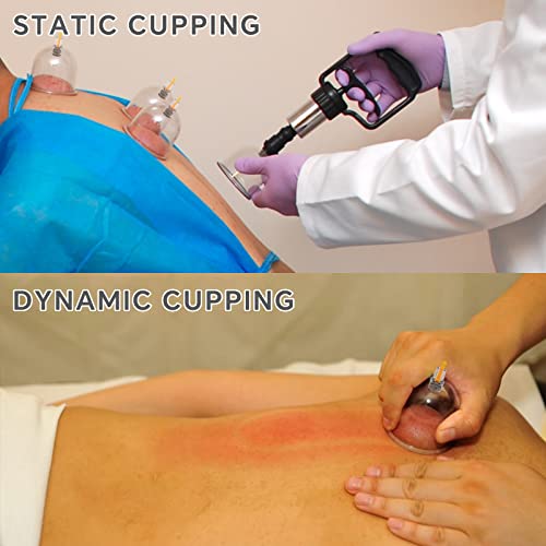 AIKOTOO Cupping Kit for Massage Therapy Set with Pump 12 Massage Cups for Cellulite Reduction Muscle Back Pain Relief Physical Therapy
