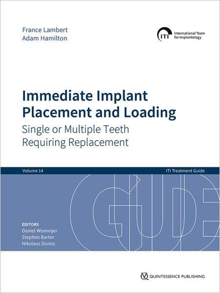 ITI Treatment Guide: Loading Protocols in Implant Dentistry