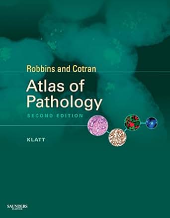 Amazon Com Robbins And Cotran Atlas Of Pathology E Book