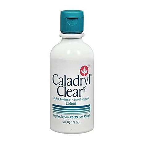 caladryl lotion for acne