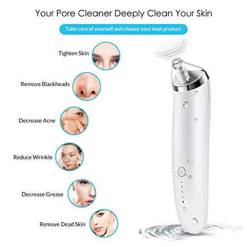 Blackhead Remover, Apolol Blackhead Vacuum Suction Removal, Acne Extractor Tool Set, Skin Facial Pore Cleaner, Comedo Microdermabrasion Exfoliating Machine for Women & Men    - Thumbnail 4