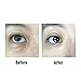 Cell Renewing Eye Gel Best for Under Eye Dark Circles, Puffiness, Bags and Wrinkles | With Anti-Aging Echinacea, Hyaluronic Acid and Licorice by Kenko Botanics | 15ml
