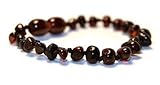 The Art of Cure Baltic Amber Bracelet 5.5 Inch - (Cherry) - Anti-inflammatory