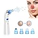 Blackhead Remover, Blackhead Extractor Acne Remover Facial Pore Cleanser Microdermabrasion Set SROCKER Newest Standable USB Rechargeable 5 Adjustable Suction Power with 4 Multi-Functional Probe