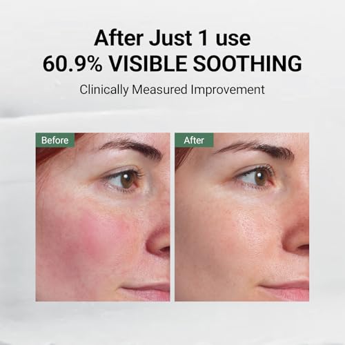 DA EFFECT Post Care Balm – Hydrating Barrier Repair Balm, Face Moisturizer with TECA & Ginseng Exosome | for Sensitive Skin, Helps Soothe Visible Redness & Dryness, 30ml (Unscented, 30, Milliliters)