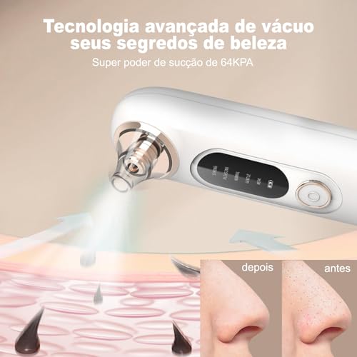 Sugador de Cravos, Máquina de Beleza para Remoção de Acne com 3 Modos e 6 Pontas de Sucção, Branco