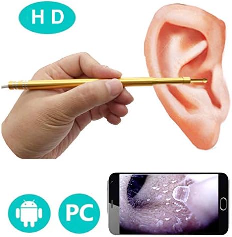 WAOBE USB Endoscope, 3 In 1 Ear Cleaning Tool Digital Otoscope Ear Spoon Micro & Type-C & USB Inspection Ear Endoscope Camera For IOS Iphone Android Smartphone