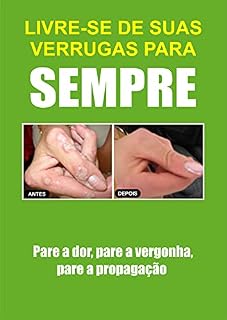 Livro Como Remover Verrugas Rapidamente de Forma Natural Para Sempre
