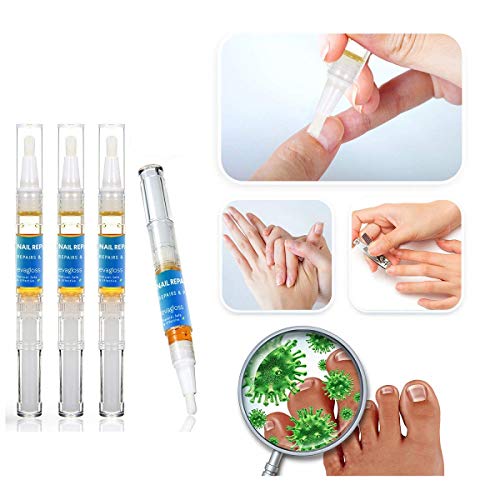 Aroamas, Fungus Stop Nail Repair Pen Fungus Nail Care Solution for Fungus on Toenails and Fingernails 4 Pens Included