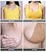 Breast