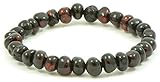 Baltic Amber Bracelet for Adults Made on Elastic Band - 7 Inches - Cherry Color - Baltic Amber Land - Hand-made From Polished / Certified Baltic Amber Beads (Cherry)