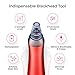 NOEL Blackhead Remover - Pore Vacuum Suction Cleanser & Pimple Popper - Comedone Extractor Acne Removal Cleansing Tool - Includes 5 Heads, 2 Silica Gel Rings, 5 Sponges - Unisex Facial Clean Kit