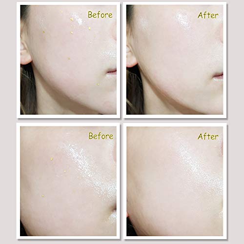 Korean Skin Care - 24K GOLD CCLIMGLAM LUXURY Serum for Face, Anti Aging, Anti Wrinkle, Skin whitening, Face Moisturizer for Dry Skin, Korean K Beauty Facial Serum - 1.76 oz 4 Korean Skin Care - 24K GOLD CCLIMGLAM LUXURY Serum for Face, Anti Aging, Anti Wrinkle, Skin whitening, Face Moisturizer for Dry Skin, Korean K Beauty Facial Serum - 1.76 oz