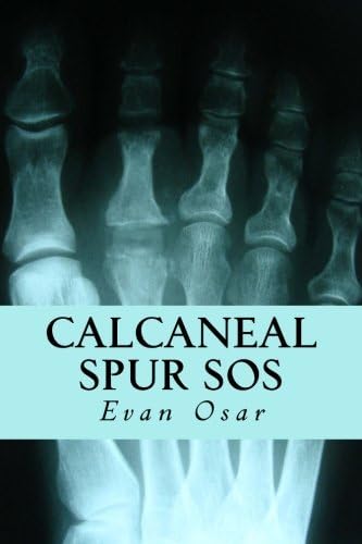 Calcaneal Spur SOS: How to Treat A Calcaneal Spur Naturally and Get Quick Relief from Foot Pain