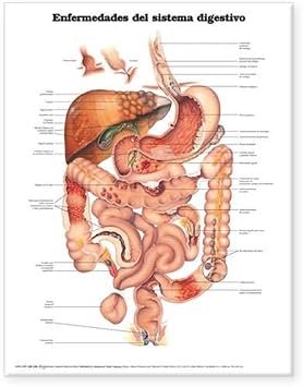 Diseases Of The Digestive System Anatomical Chart In Spanish (Enfermedades Del Sistema Digestivo) (9781587799853)