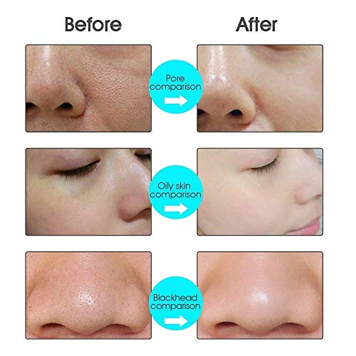 Facial Cleanser Brush, 3 in 1 Electric Rotating Facial Cleansing Brush USB Rechargeable Sonic Face Cleaners Scrubber SPA Skin Care Tool Beauty Instrument - Thumbnail 5