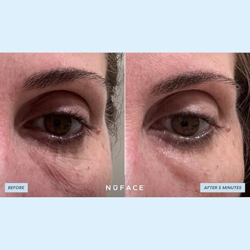 NuFACE IonPlex Hydra-Gel Power Under Eye Patches - Gel Under Eye Mask for Puffy Eyes & Dark Circles - Cooling Wrinkle Patches & Hydrating Treatment Pads to Energize, Brighten & Tighten (60 Count)