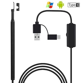 Amazon.com: Ear Endoscope, AOJOYS HD 3 in 1 Visual Ear