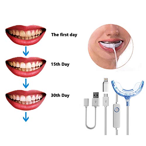 Professional Teeth Whitening Kit, Complete All-in-One At-Home System,16-LED Whiten Accelarator Light,3 Hydrogen Peroxide Whitening Pens,Whiten Tray with iPhone/Android/USB Adapter for Home Use