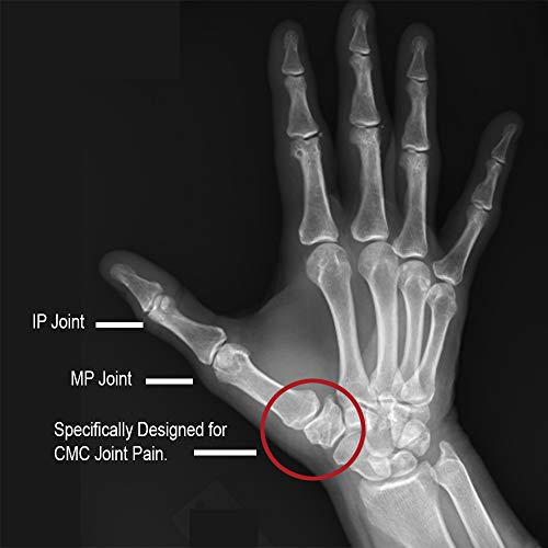 Comfort Cool Thumb Cmc Restriction Splint Beige Patented Thumb