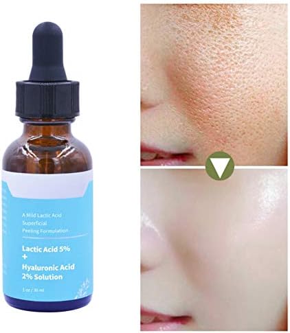 Abbra Lactic Acid Solution + Hyaluronic Acid Exfoliating Moisturizing Facial Serum Face Care