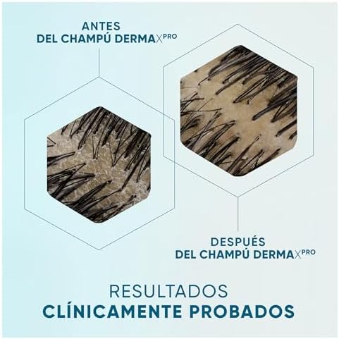 H&S DermaXPro Champú Anticaspa, Acondicionador y Tratamiento 300+220+145ml