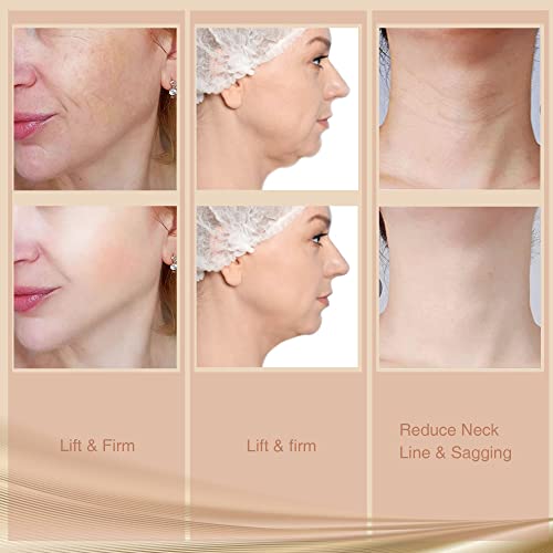 RF Machine for Face and Neck, RadioFrequency Facial Device Skin Care