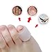Sumifun Gel Toe Protector, Open Toe Sleeves for Bunions, (6 Thin+6 Thick) Pinky Silicone Toe Protectors for Corns, Hammer Toes, Toenails Loss, Friction Pain Relief
