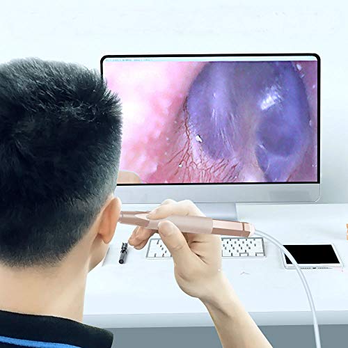 Upgrade Portable Ear Cleaning Endoscope, 3 in 1 Multifunctional Visual Digital Ear Cleaner Camera Earwax Remover Tool Kits Compatible with Android Smart Phones Windows & MAC System (Gold)