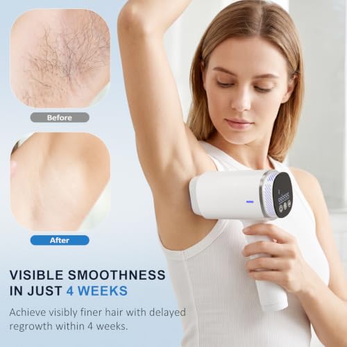 NALONE 22J Pulsed Light Epilator Touch Screen, 4-IN-1 Definitive Laser Hair Removal -HR/SC/RA/BT, 10 Levels Home Women & Men, Face, Body, Armpits